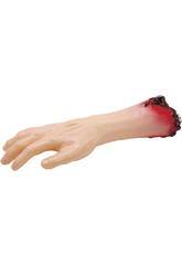 imagen Brazo amputado