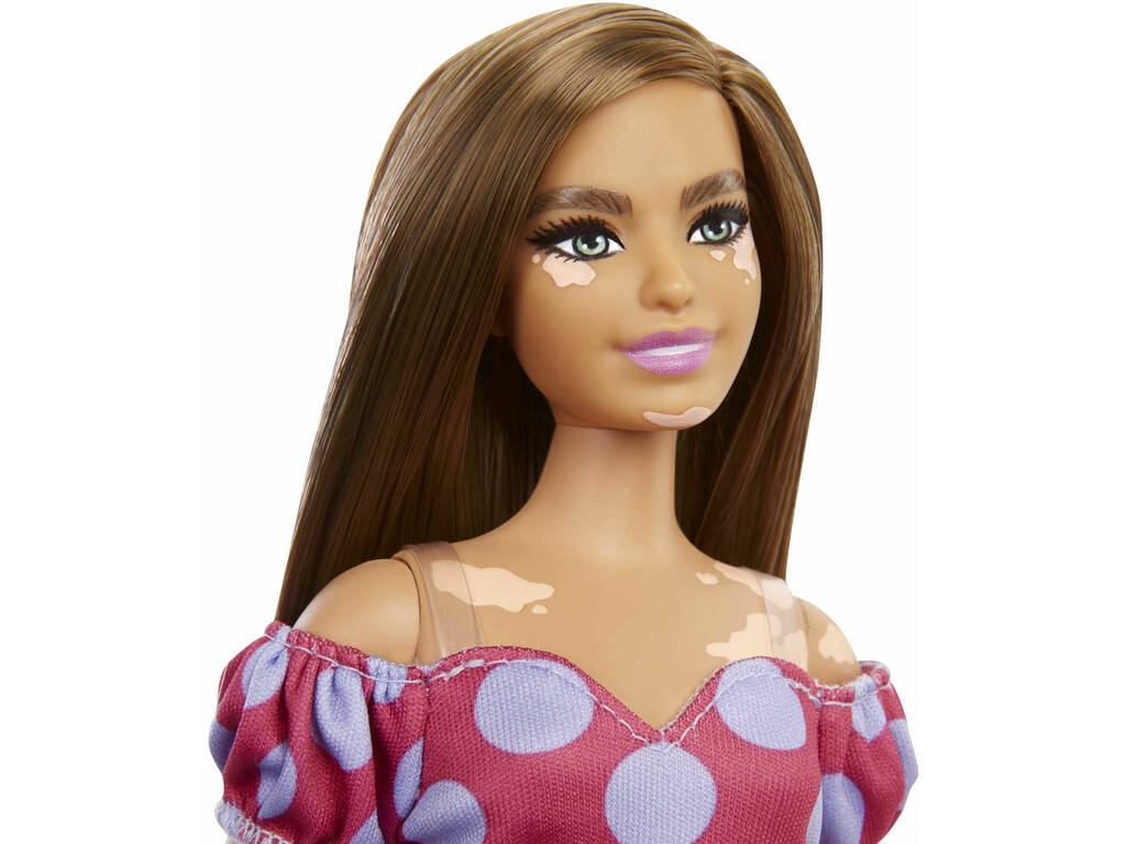 Barbie Fashionista Vitiligio con abito a pois Mattel GRB62