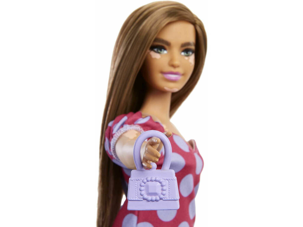 Barbie Fashionista Vitiligio con abito a pois Mattel GRB62